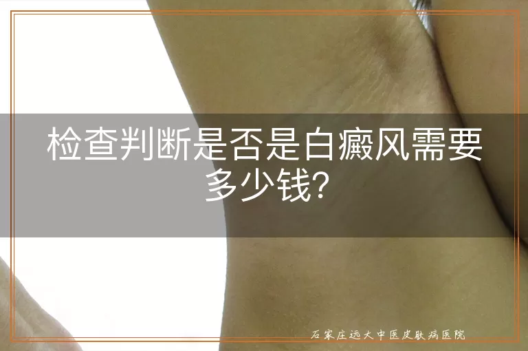 检查判断是否是白癜风需要多少钱？