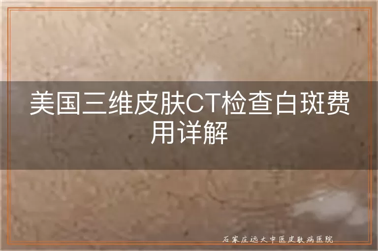 美国三维皮肤CT检查白斑费用详解