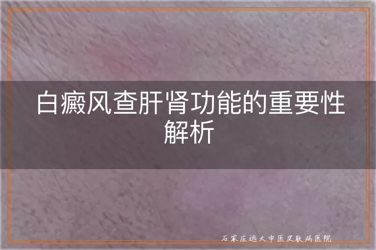 白癜风查肝肾功能的重要性解析