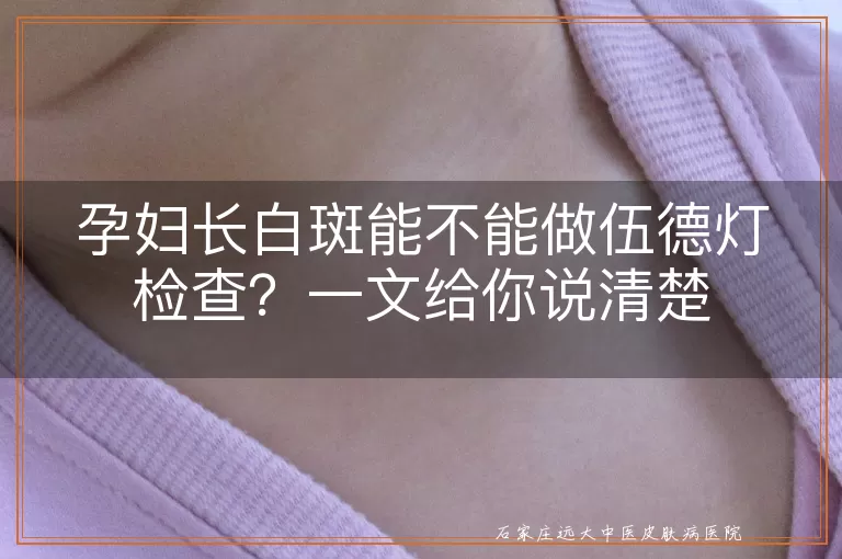 孕妇长白斑能不能做伍德灯检查？一文给你说清楚
