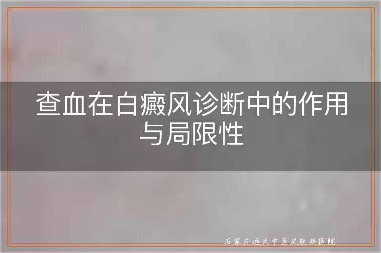 查血在白癜风诊断中的作用与局限性