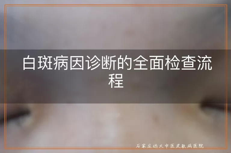 白斑病因诊断的全面检查流程