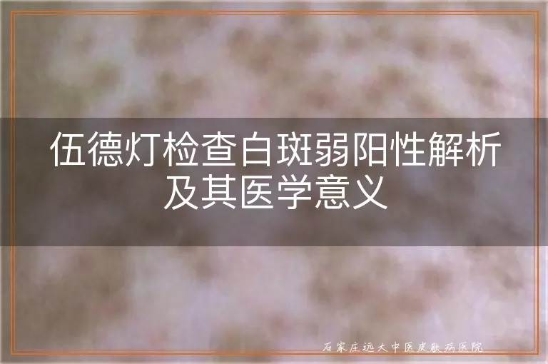伍德灯检查白斑弱阳性解析及其医学意义