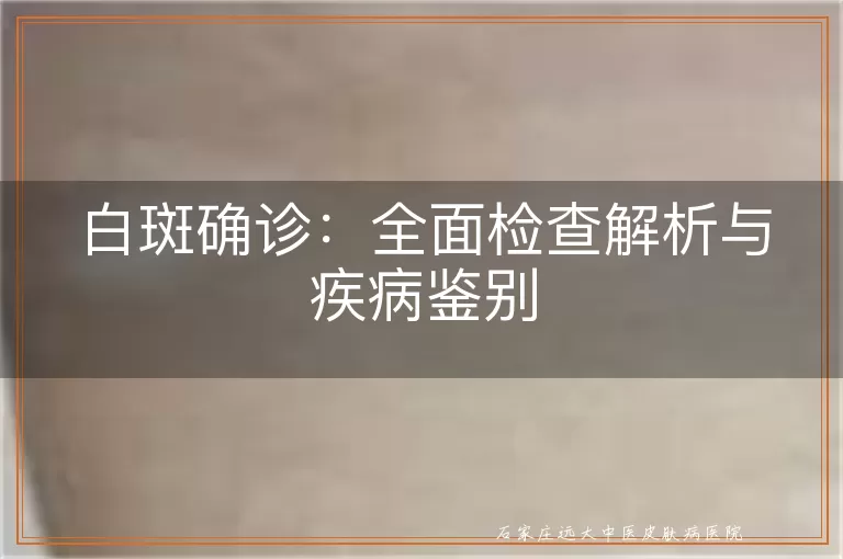 白斑确诊：全面检查解析与疾病鉴别