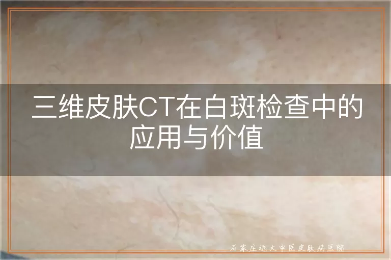 三维皮肤CT在白斑检查中的应用与价值