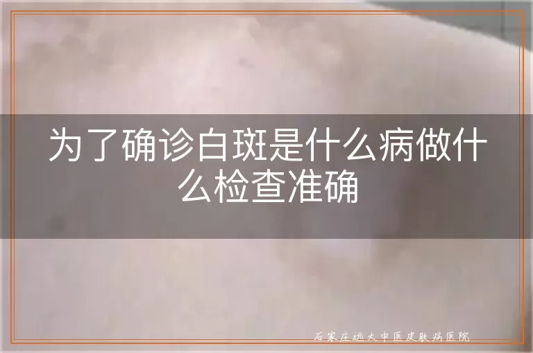 为了确诊白斑是什么病做什么检查准确