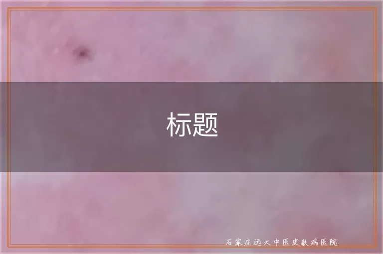 皮肤CT查白斑出结果时间详解