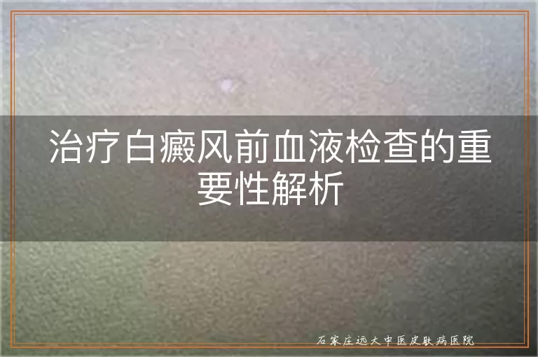 治疗白癜风前血液检查的重要性解析