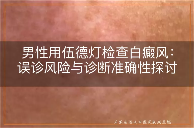 男性用伍德灯检查白癜风：误诊风险与诊断准确性探讨
