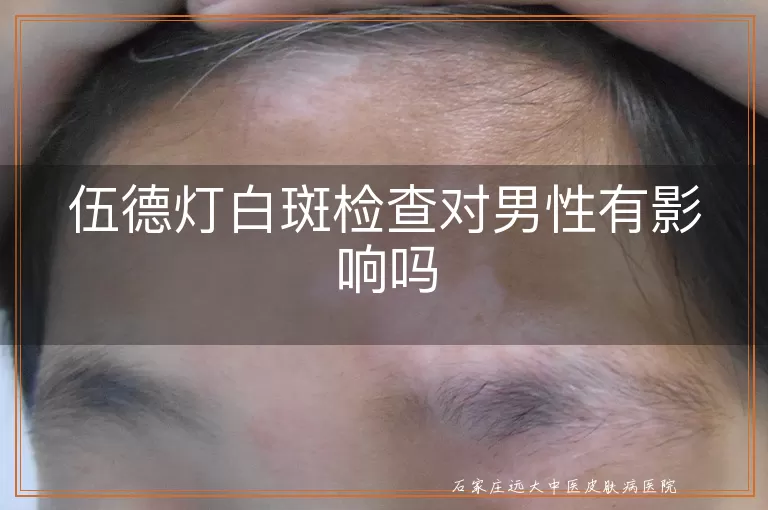 伍德灯白斑检查对男性有影响吗