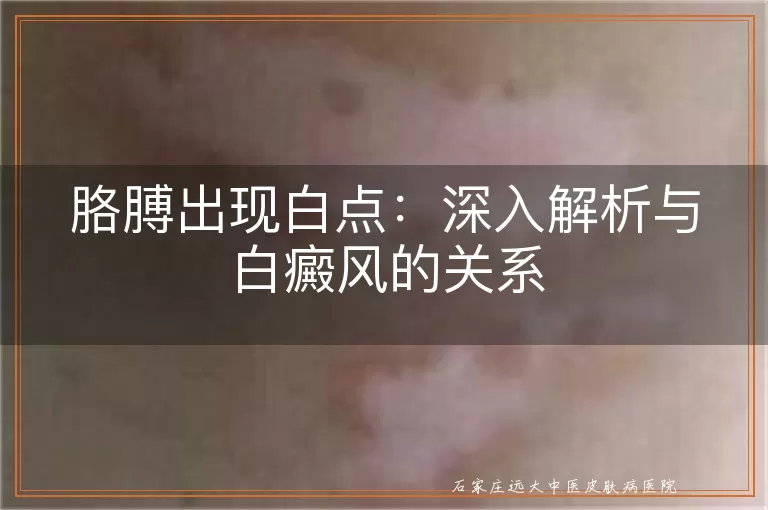 胳膊出现白点:深入解析与白癜风的关系