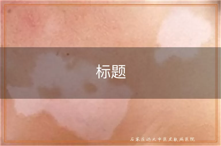 白斑照射美国三维皮肤CT的费用探讨