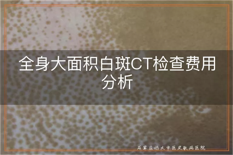 全身大面积白斑CT检查费用分析