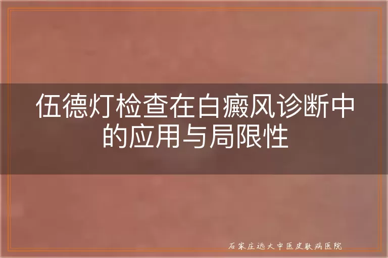 伍德灯检查在白癜风诊断中的应用与局限性
