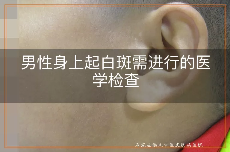 男性身上起白斑需进行的医学检查