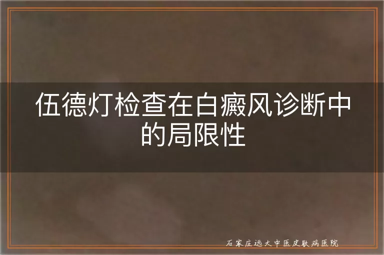 伍德灯检查在白癜风诊断中的局限性