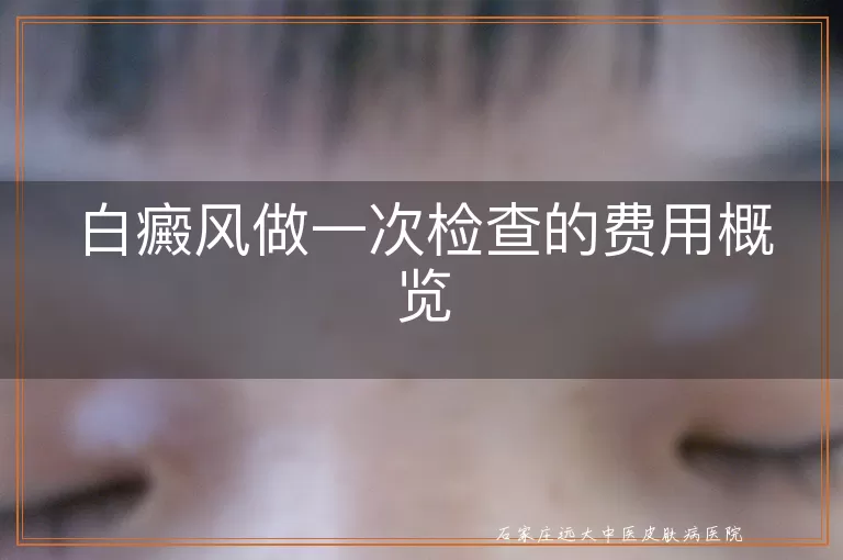 白癜风做一次检查的费用概览
