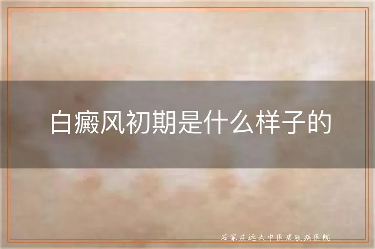 白癜风初期是什么样子的