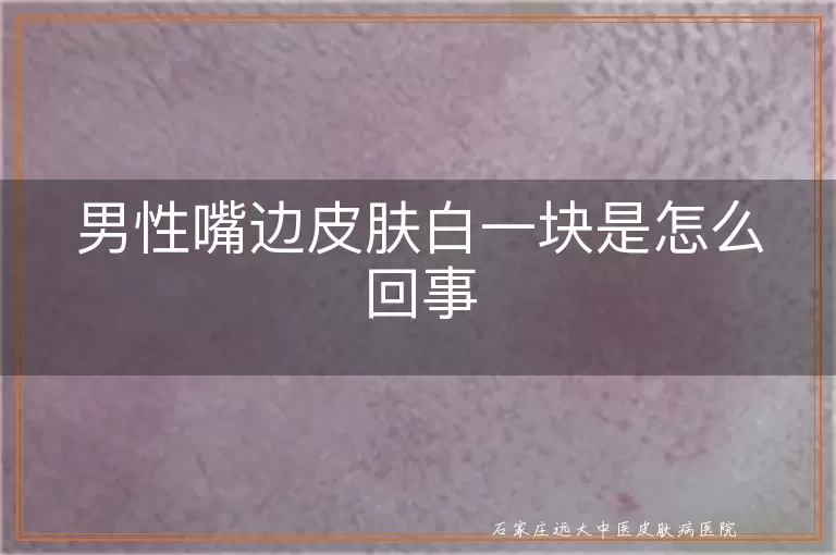 男性嘴边皮肤白一块是怎么回事