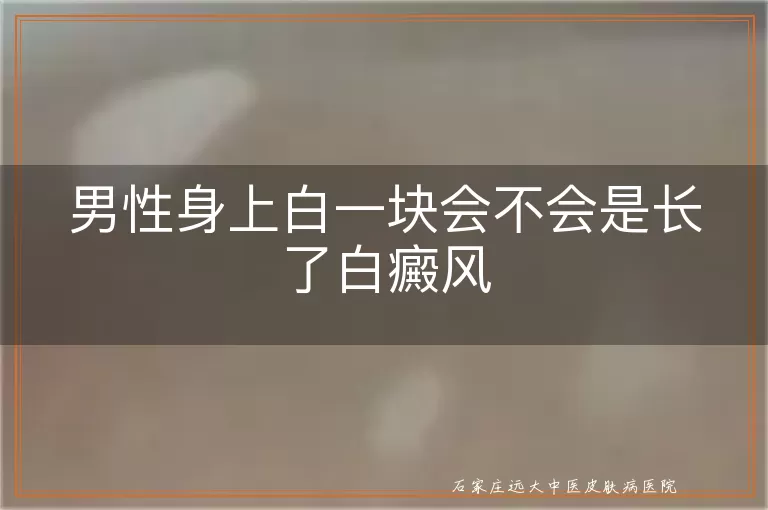 男性身上白一块会不会是长了白癜风