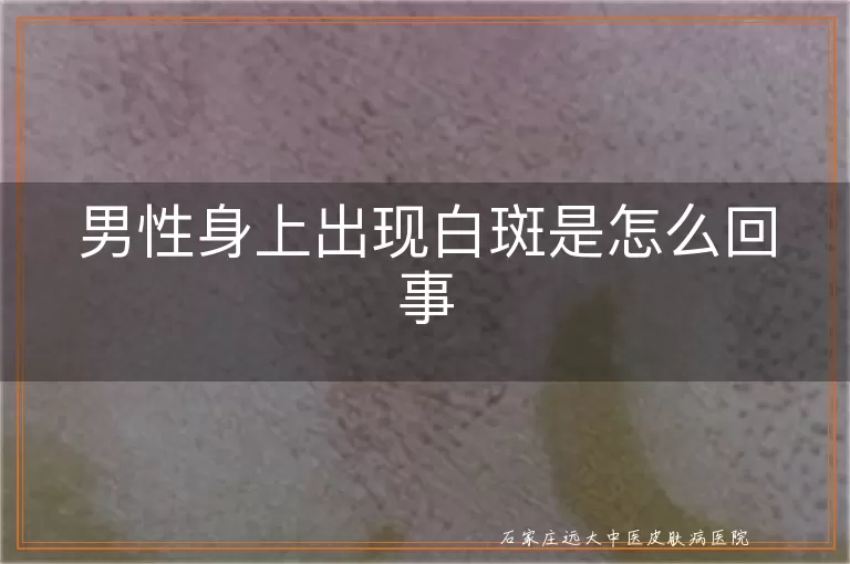 男性身上出现白斑是怎么回事