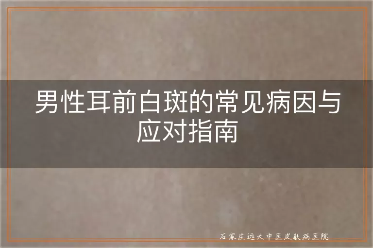 男性耳前白斑的常见病因与应对指南