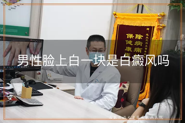 男性脸上白一块是白癜风吗