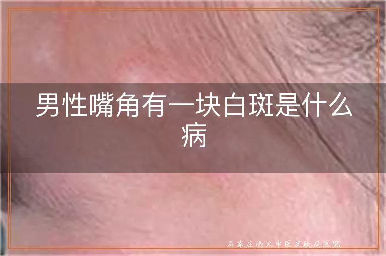男性嘴角有一块白斑是什么病