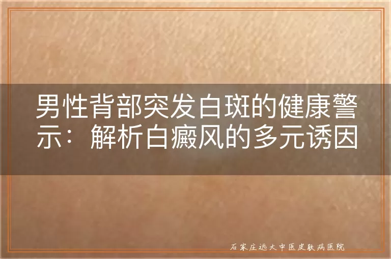 男性背部突发白斑的健康警示:解析白癜风的多元诱因