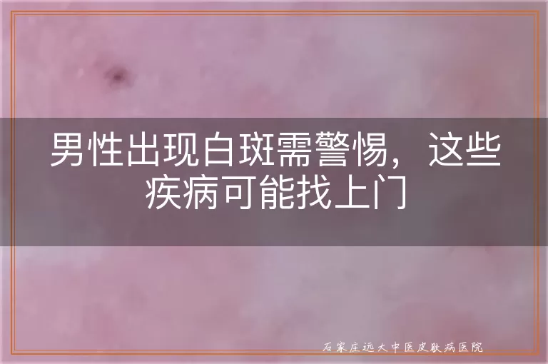 男性出现白斑需警惕,这些疾病可能找上门