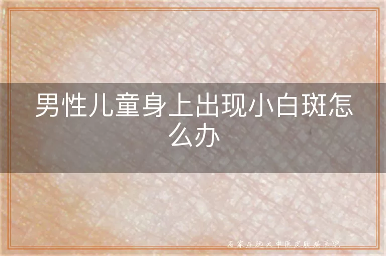 男性儿童身上出现小白斑怎么办