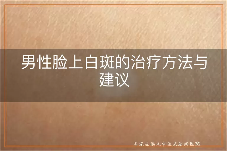 男性脸上白斑的治疗方法与建议