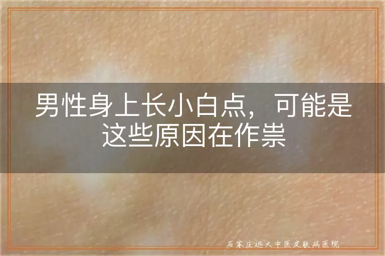 男性身上长小白点，可能是这些原因在作祟