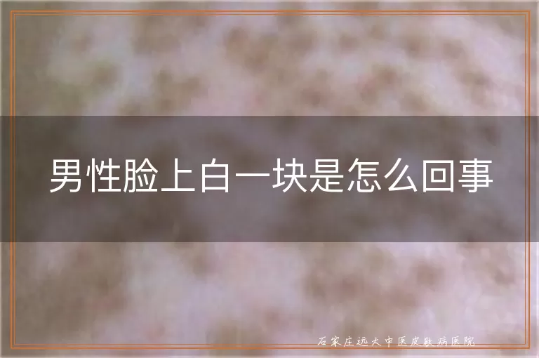 男性脸上白一块是怎么回事
