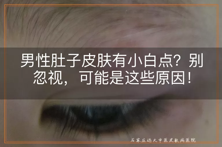男性肚子皮肤有小白点？别忽视，可能是这些原因！