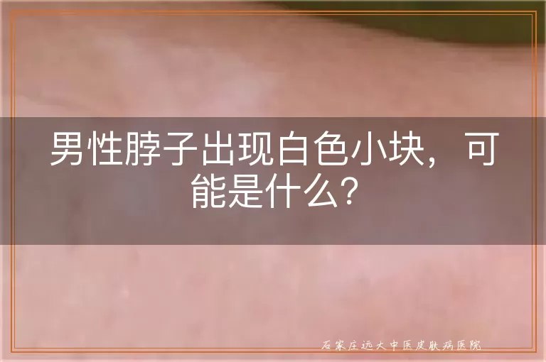 男性脖子出现白色小块，可能是什么？