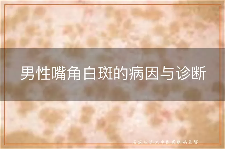 男性嘴角白斑的病因与诊断