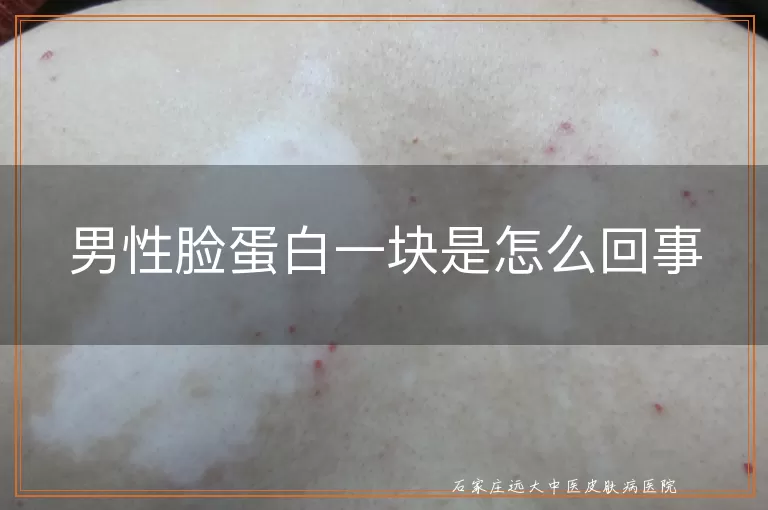 男性脸蛋白一块是怎么回事