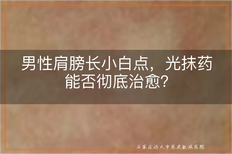 男性肩膀长小白点，光抹药能否彻底治愈？