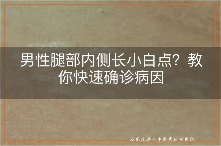 男性腿部内侧长小白点？教你快速确诊病因