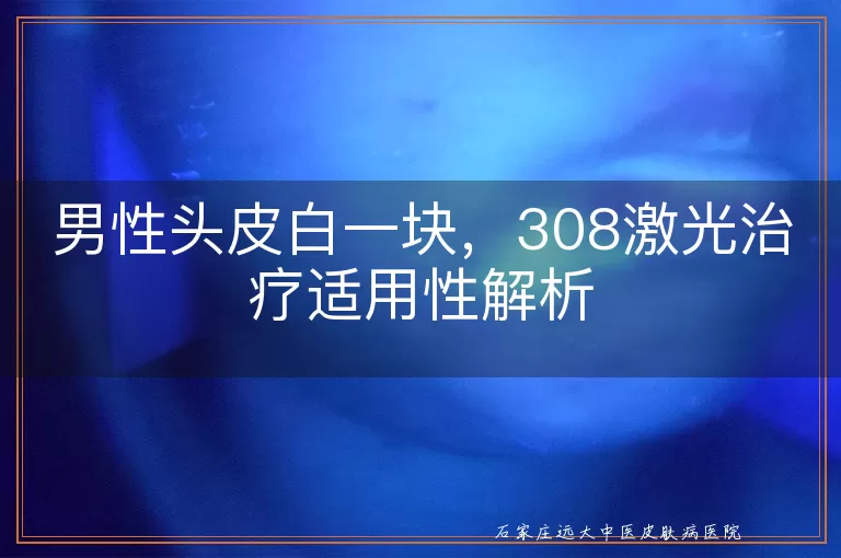 男性头皮白一块，308激光治疗适用性解析