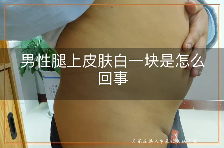 男性腿上皮肤白一块是怎么回事