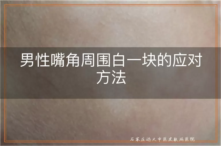 男性嘴角周围白一块的应对方法
