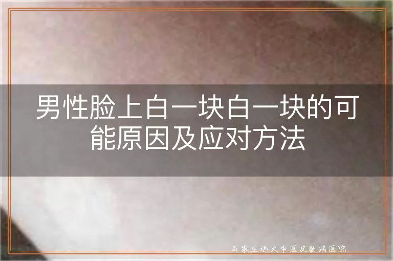 男性脸上白一块白一块的可能原因及应对方法