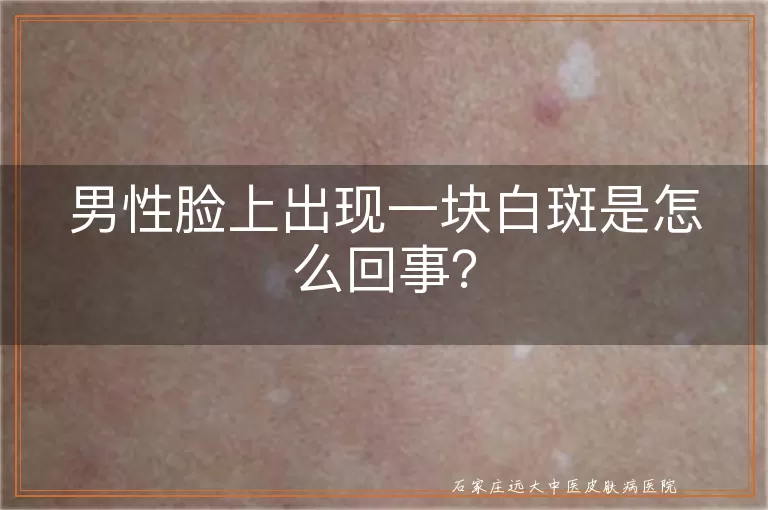 男性脸上出现一块白斑是怎么回事？