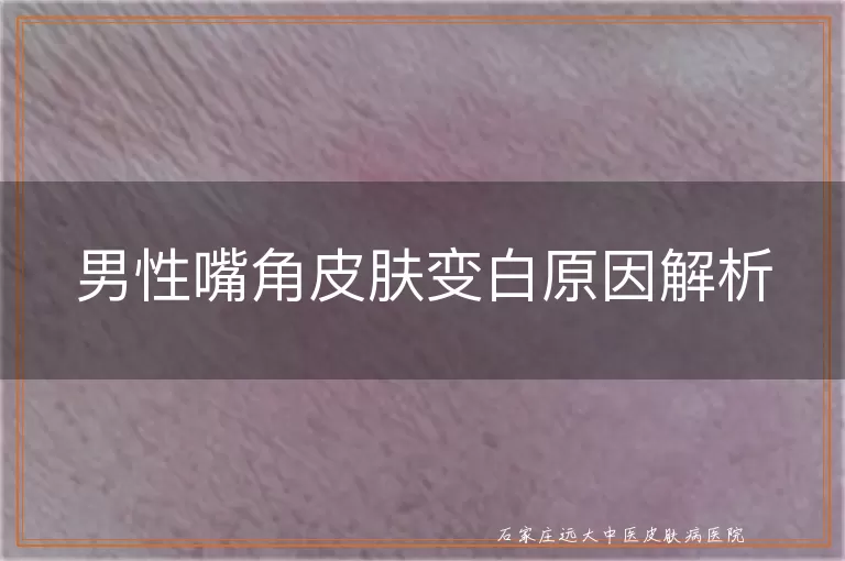 男性嘴角皮肤变白原因解析