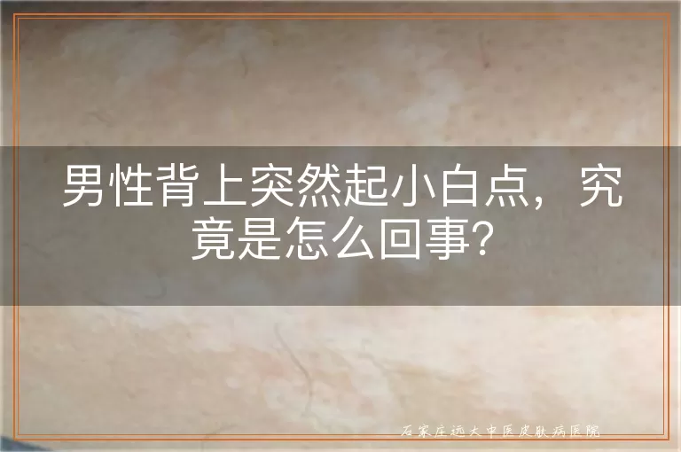 男性背上突然起小白点，究竟是怎么回事？