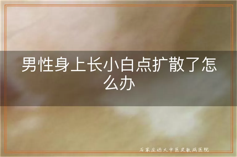 男性身上长小白点扩散了怎么办