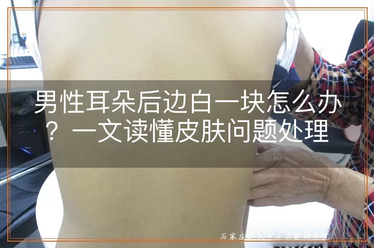 男性耳朵后边白一块怎么办？一文读懂皮肤问题处理