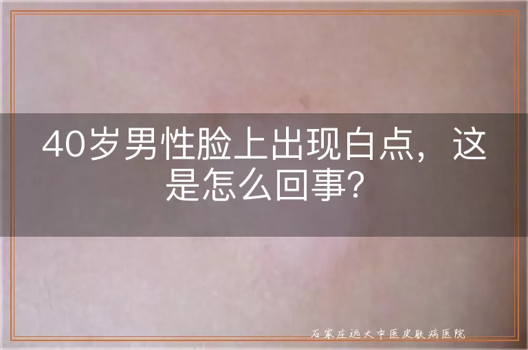 40岁男性脸上出现白点，这是怎么回事？
